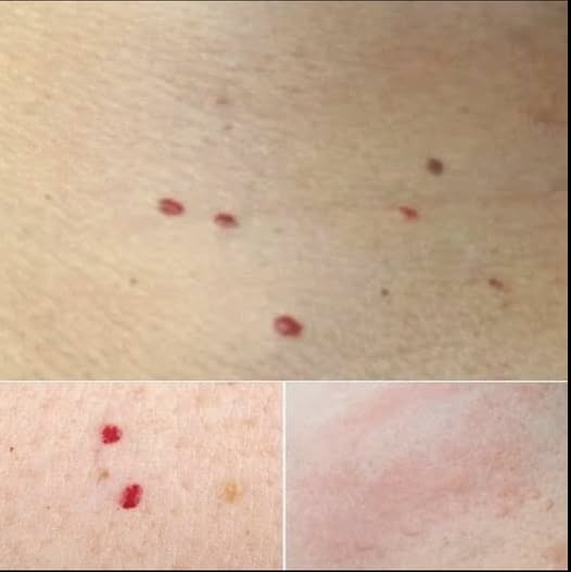 If you spot these red dots on your skin, here’s what they mean