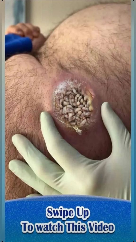 RED DOTS ON YOUR SKIN: CAUSES AND WHAT THEY MIGHT REPRESENTt