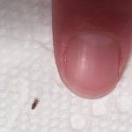 A Simple Guide to Safely Removing an Insect From Your Hair!