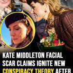 Kate Middleton facial scar claims ignite new conspiracy theory after church appearance