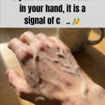 What Makes Veins More Noticeable Under the Skin!