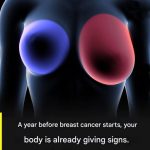 Breast Cancer Awareness: Four Early Warning Signs Every Woman Should Recognize, From Unusual Lumps and Changes in Breast Shape to Swelling in the Armpit and Persistent Pain — Understanding These Symptoms Early Can Save Lives Through Timely Detection and Proper Medical Evaluation