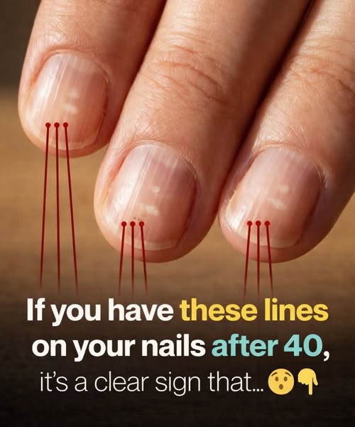 Observe your nails to detect health issues