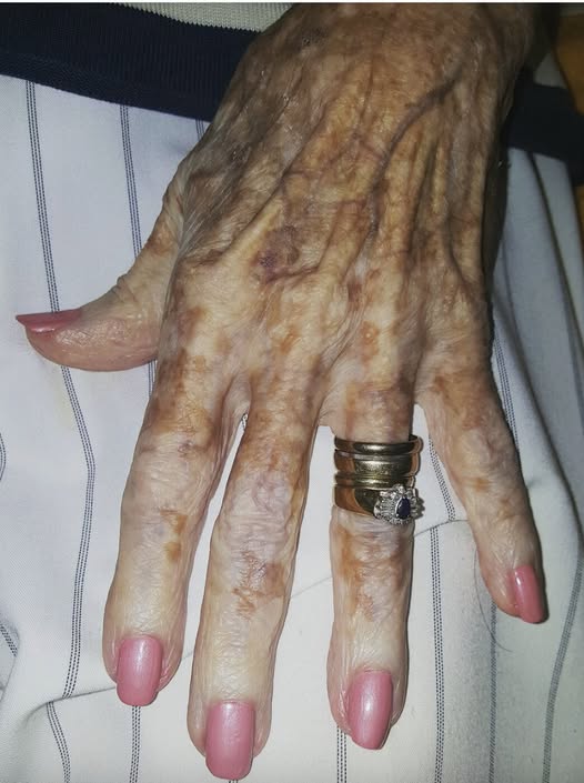 Nurse sparks internet reaction with photo of old lady’s hand